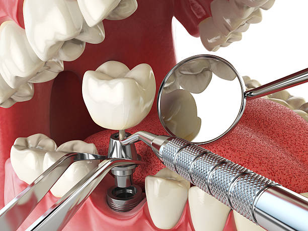 Urgent Tooth Repair in WI